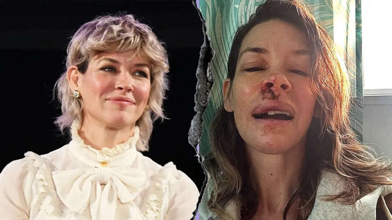 Lost e Ant-Man: Evangeline Lilly coinvolta in un grave incidente, i dettagli shock che lasciano senza parole
