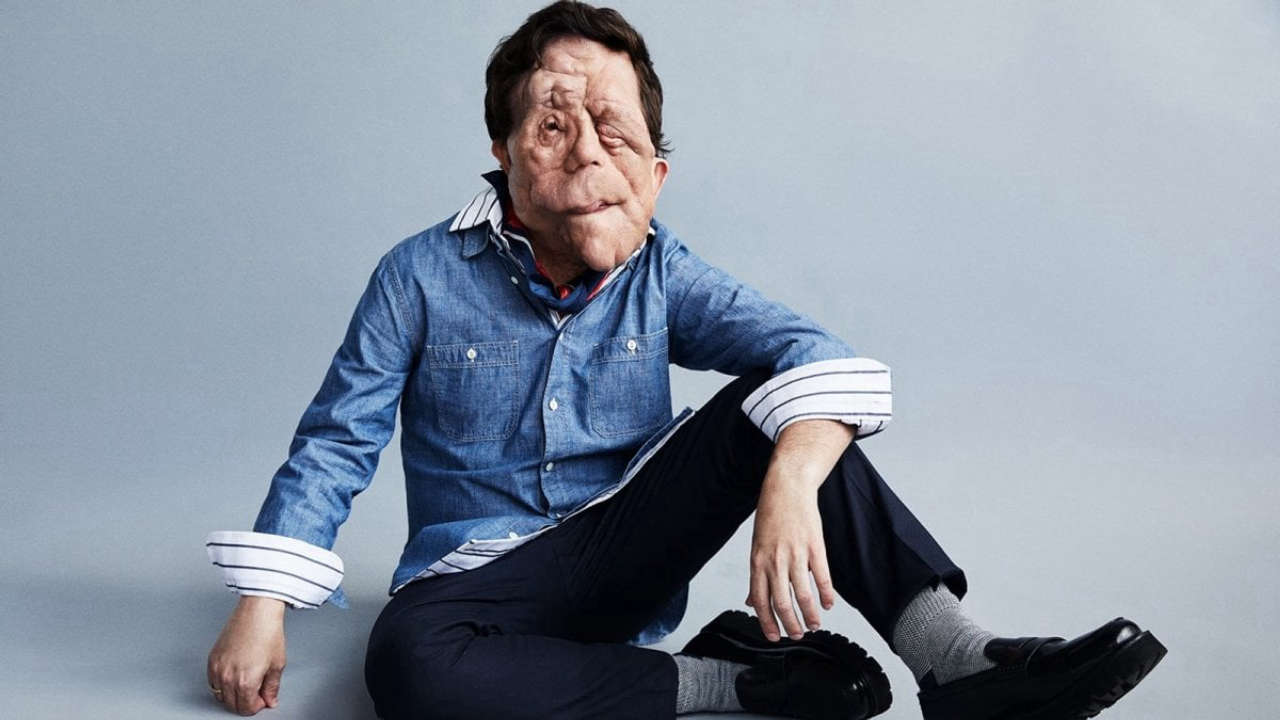 A Different Man: Adam Pearson protagonista in The Elephant Man, una trasformazione che sorprende il pubblico.