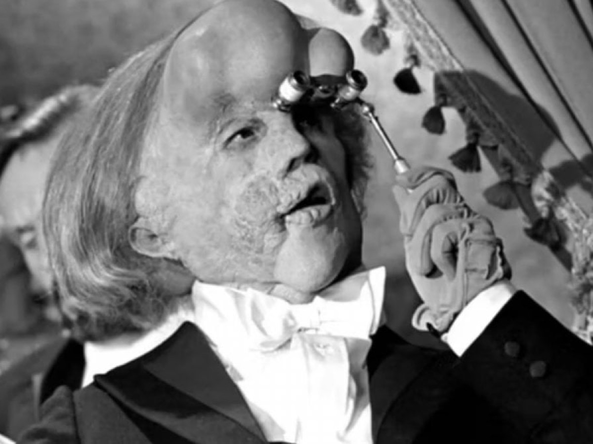David Lynch e The Elephant Man: come il cinema ribalta lo sguardo sulla diversità e l’umanità in modo sorprendente