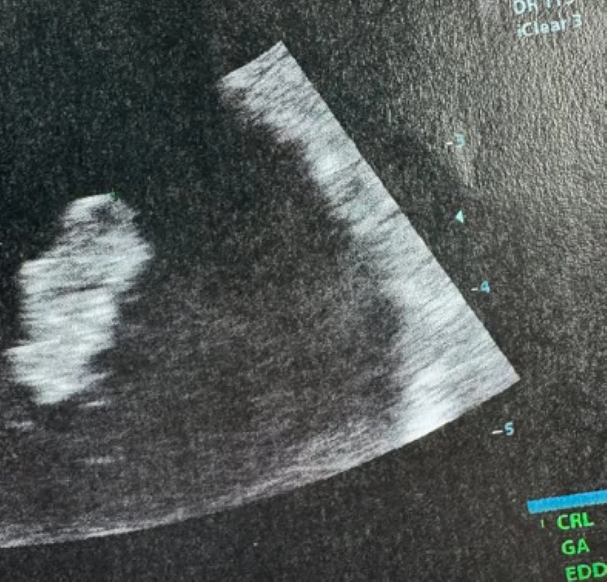 La famiglia si allarga: l’influencer italiana aspetta un terzo bambino in coincidenza con l’anniversario