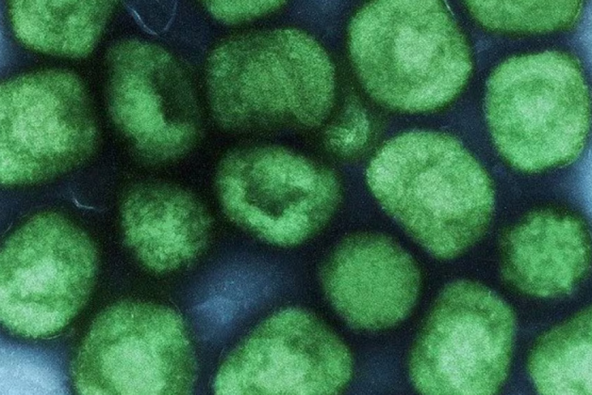 Primo caso di mpox clade 1b in Italia: il ceppo del vaiolo delle scimmie che preoccupa gli esperti