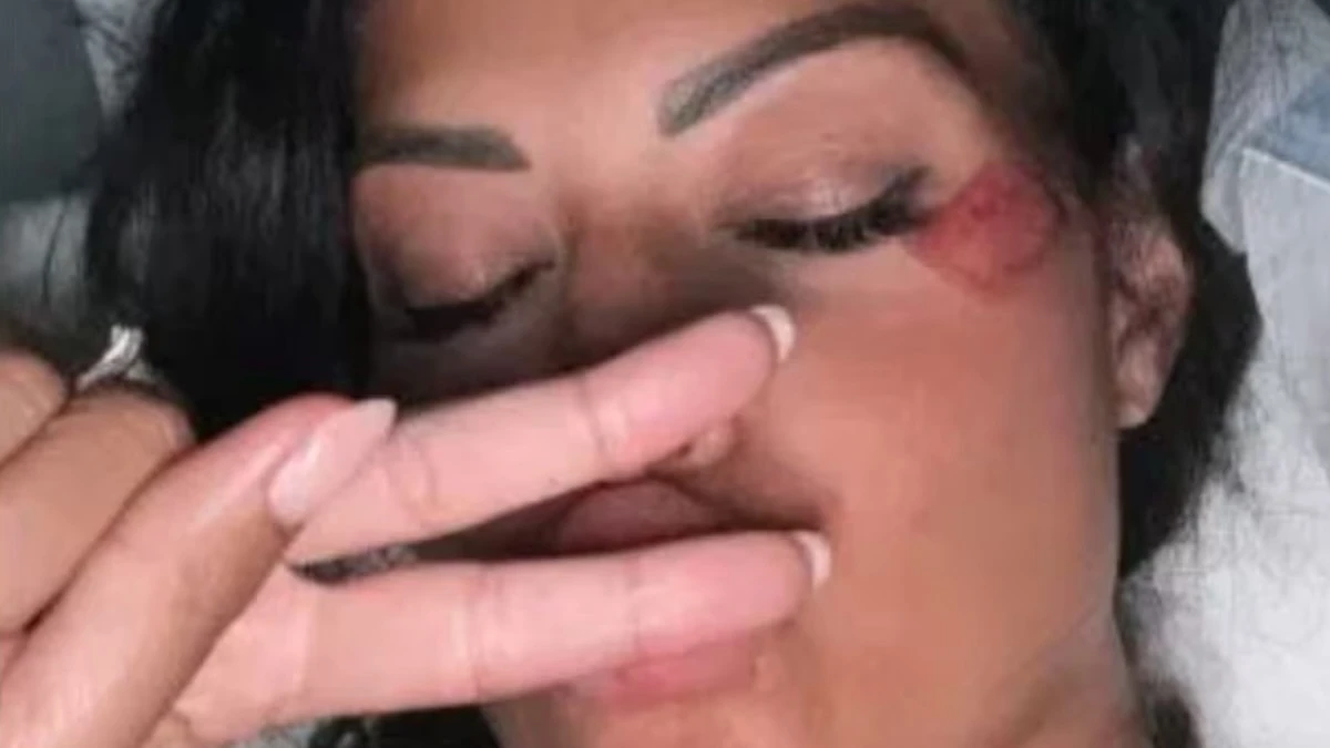 Alessia Pascarella investita mentre organizzava il compleanno della madre: il drammatico racconto sui social