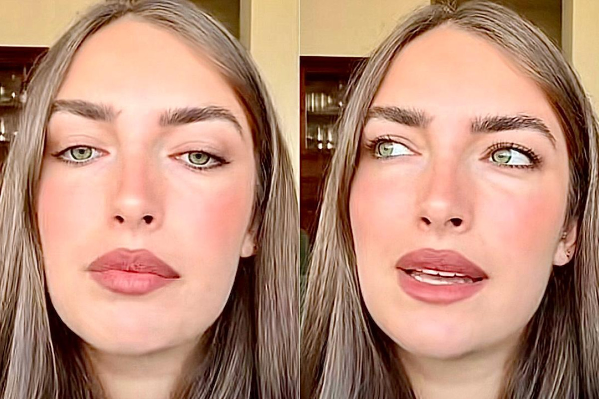 Nilufar Addati svela i suoi interventi di medicina estetica: botox e le polemiche che li circondano