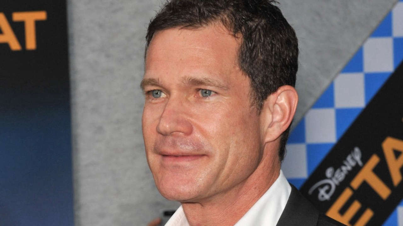 Dylan Walsh di Nip/Tuck colpito da ictus prima dell’incidente d’auto che lo ha coinvolto