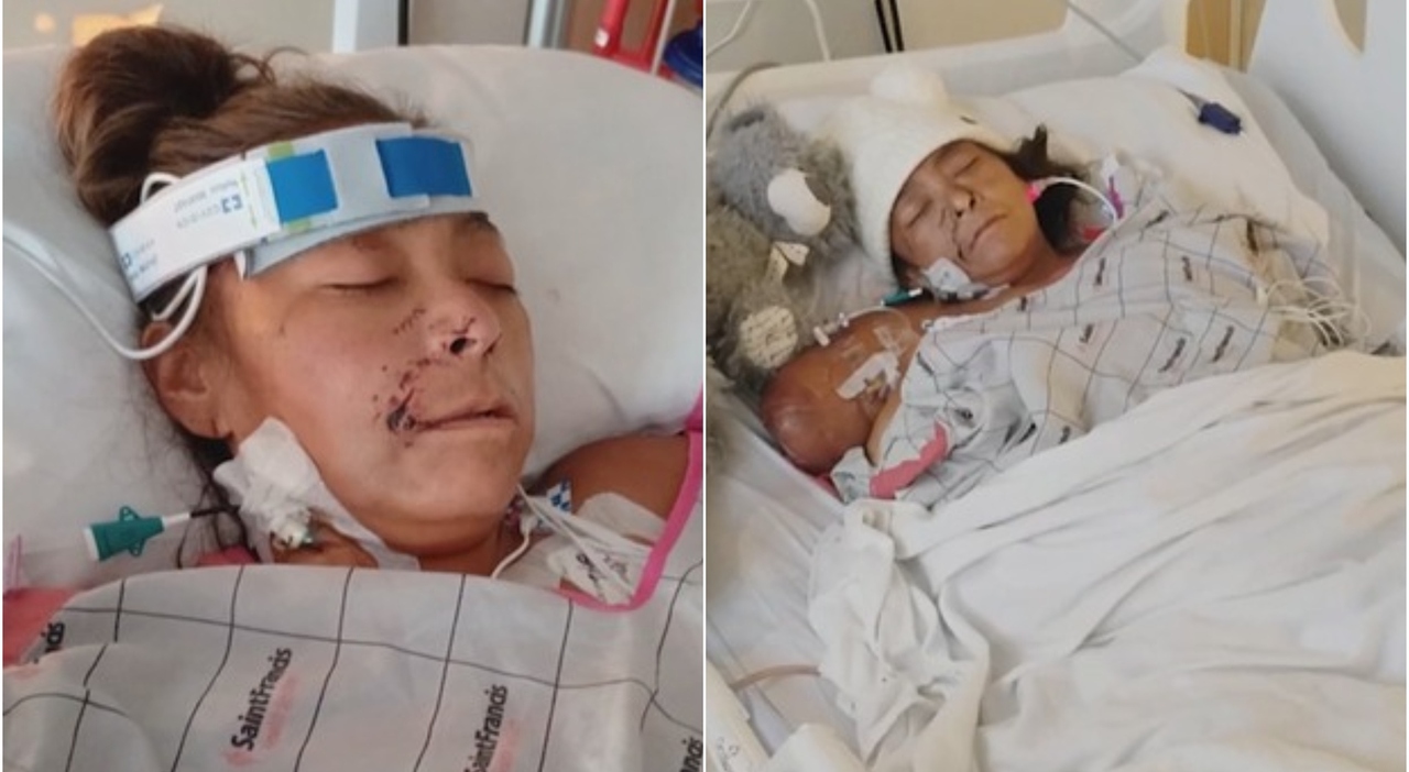 Attacco di Pitbull durante una Passeggiata in Bicicletta a Okmulgee provoca Gravi Ferite a una Donna
