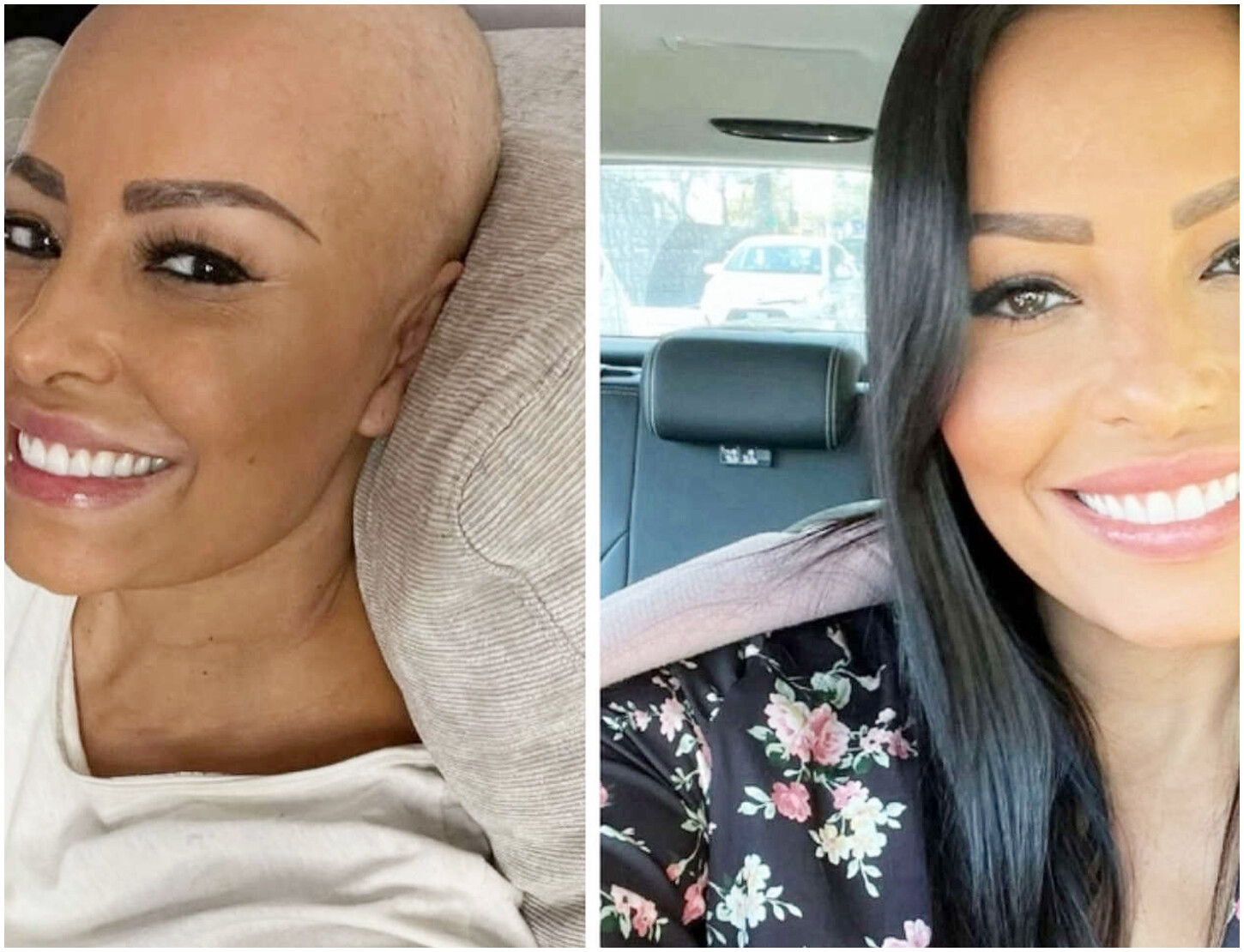 Carolina Marconi racconta la sua esperienza di perdita dopo due aborti da fecondazione artificiale Carolina Marconi racconta la sua esperienza di perdita dopo due aborti da fecondazione artificiale