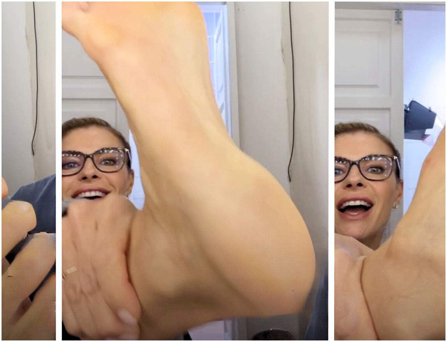 Martina Colombari sorprende mostrando i piedi durante la diretta, tra calli e cicatrici.