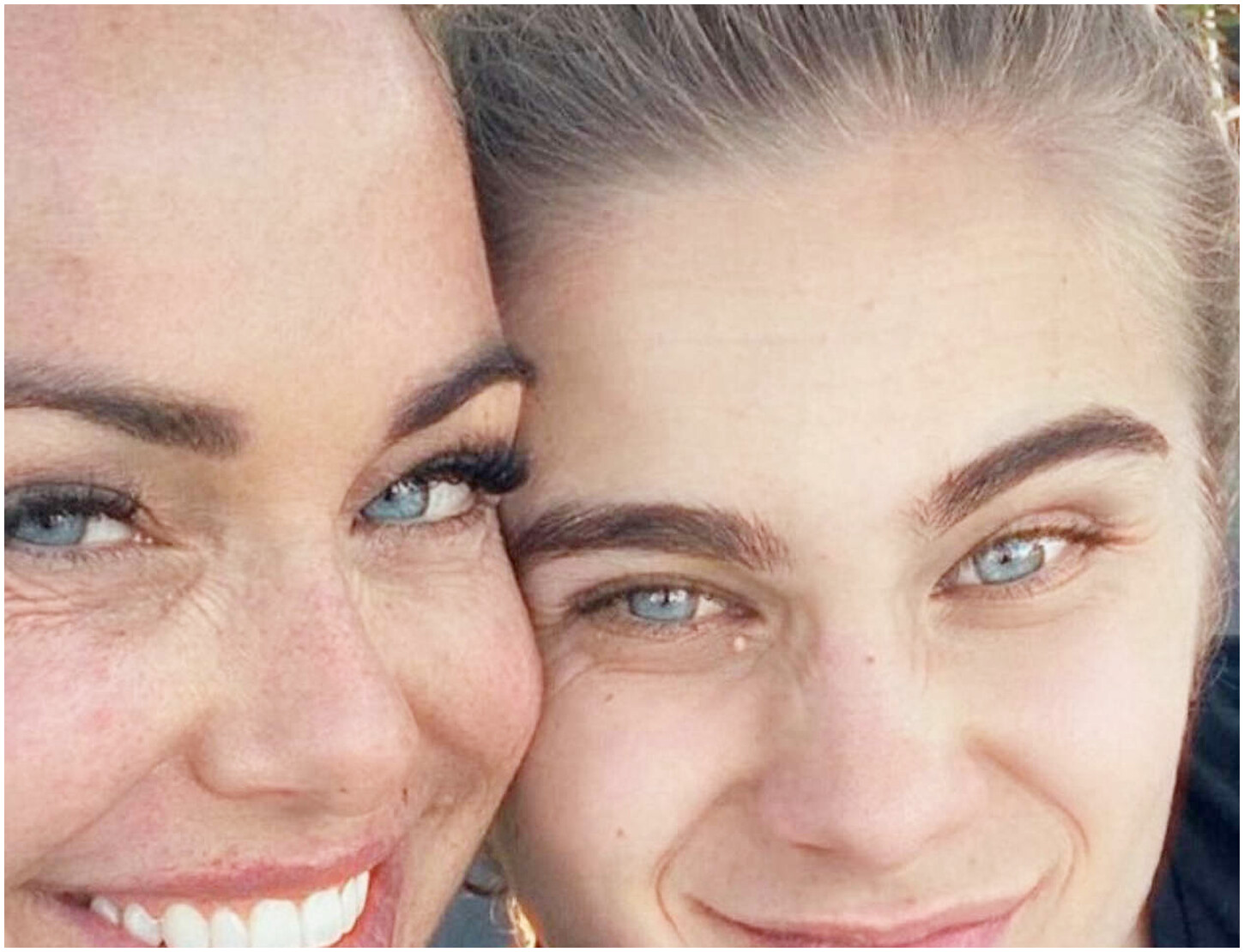 Sonia Bruganelli racconta la ferita più profonda della sua vita, un’esperienza indimenticabile Sonia Bruganelli racconta la ferita più profonda della sua vita, un’esperienza indimenticabile