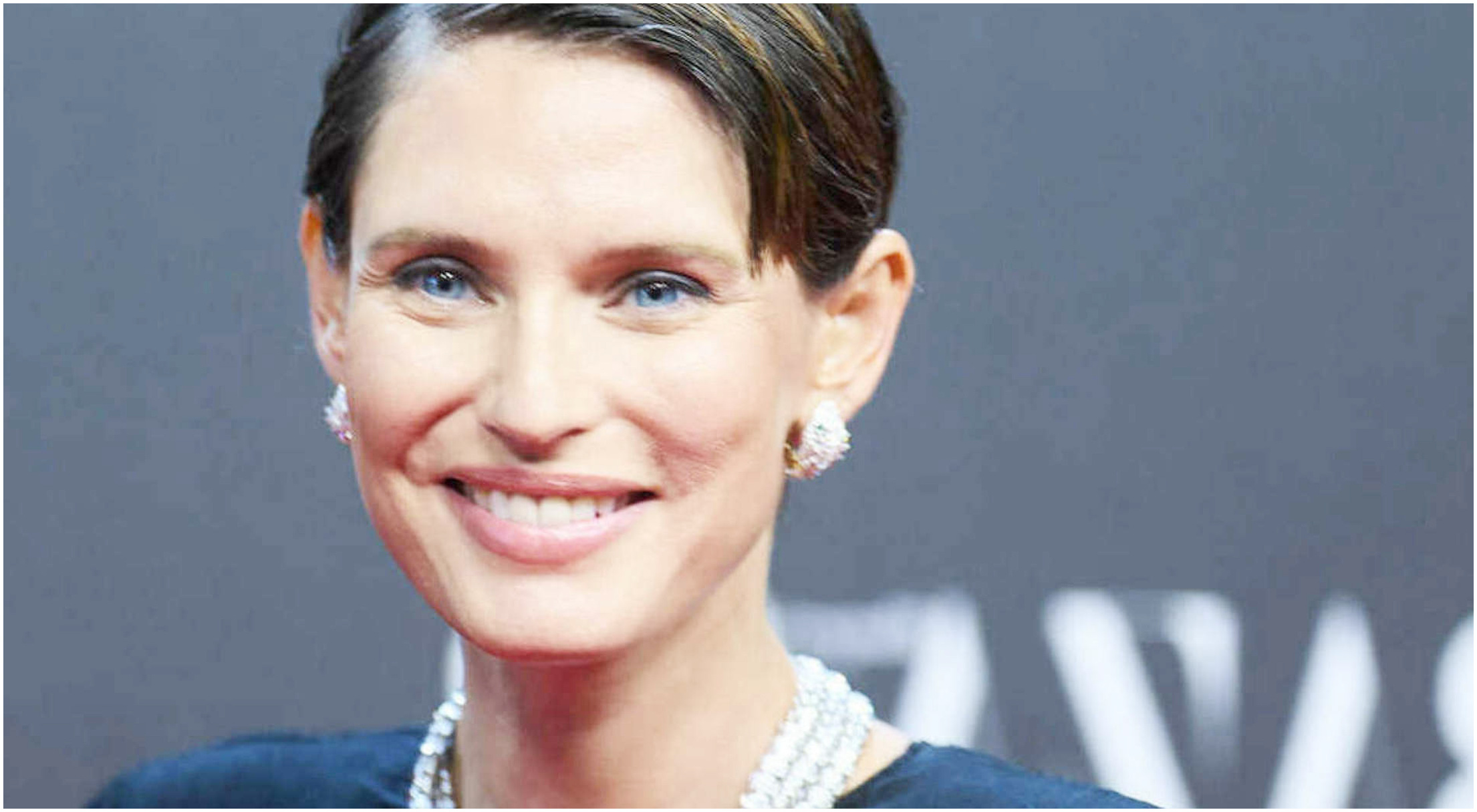 Bianca Balti racconta la sua lotta contro la malattia e il supporto della psico oncologa.