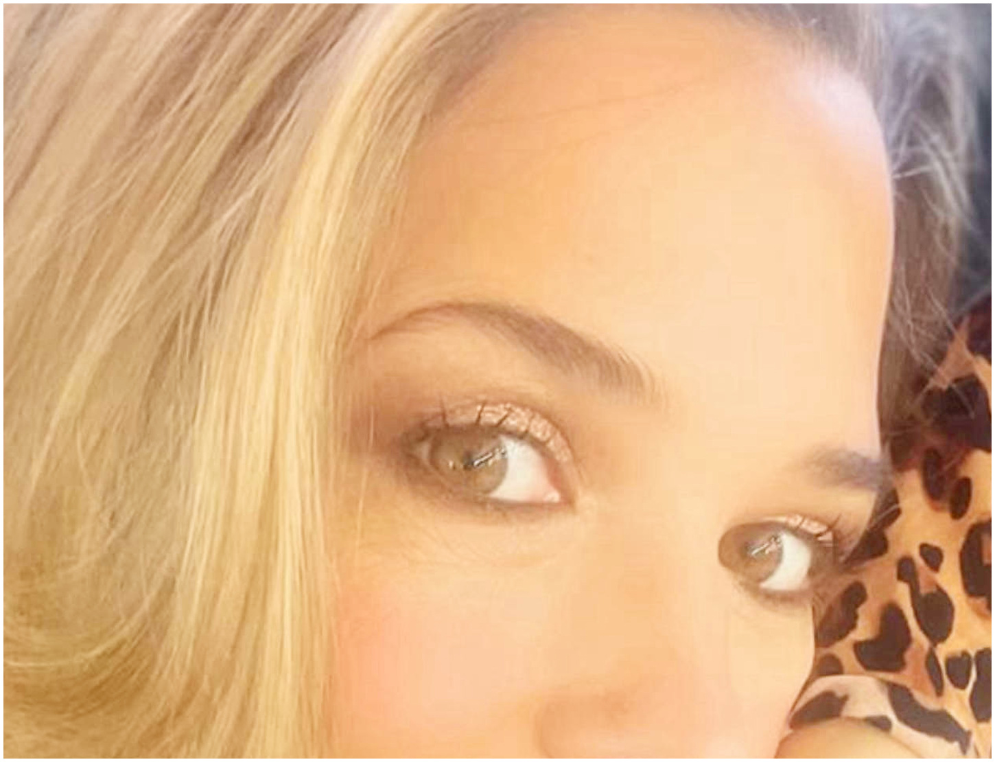 Francesca Barra svela i suoi problemi di salute legati alla diastasi dei retti addominali