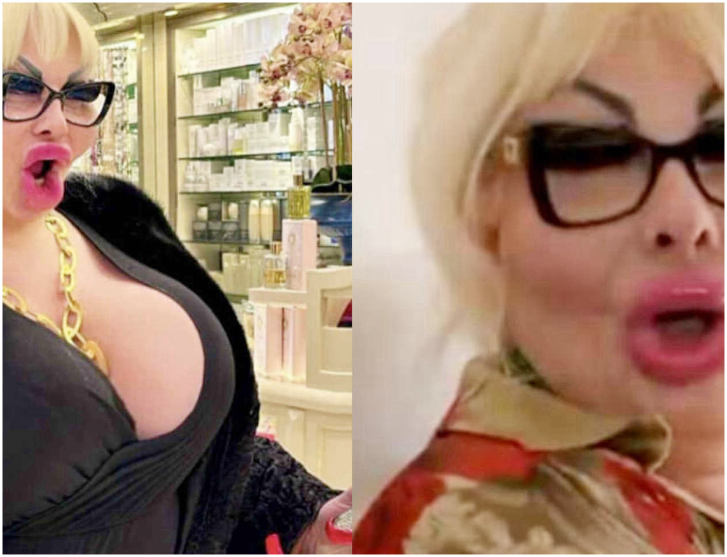 Elenoire Ferruzzi parla della sua nuova trasformazione e svela l’importo speso per l’intervento