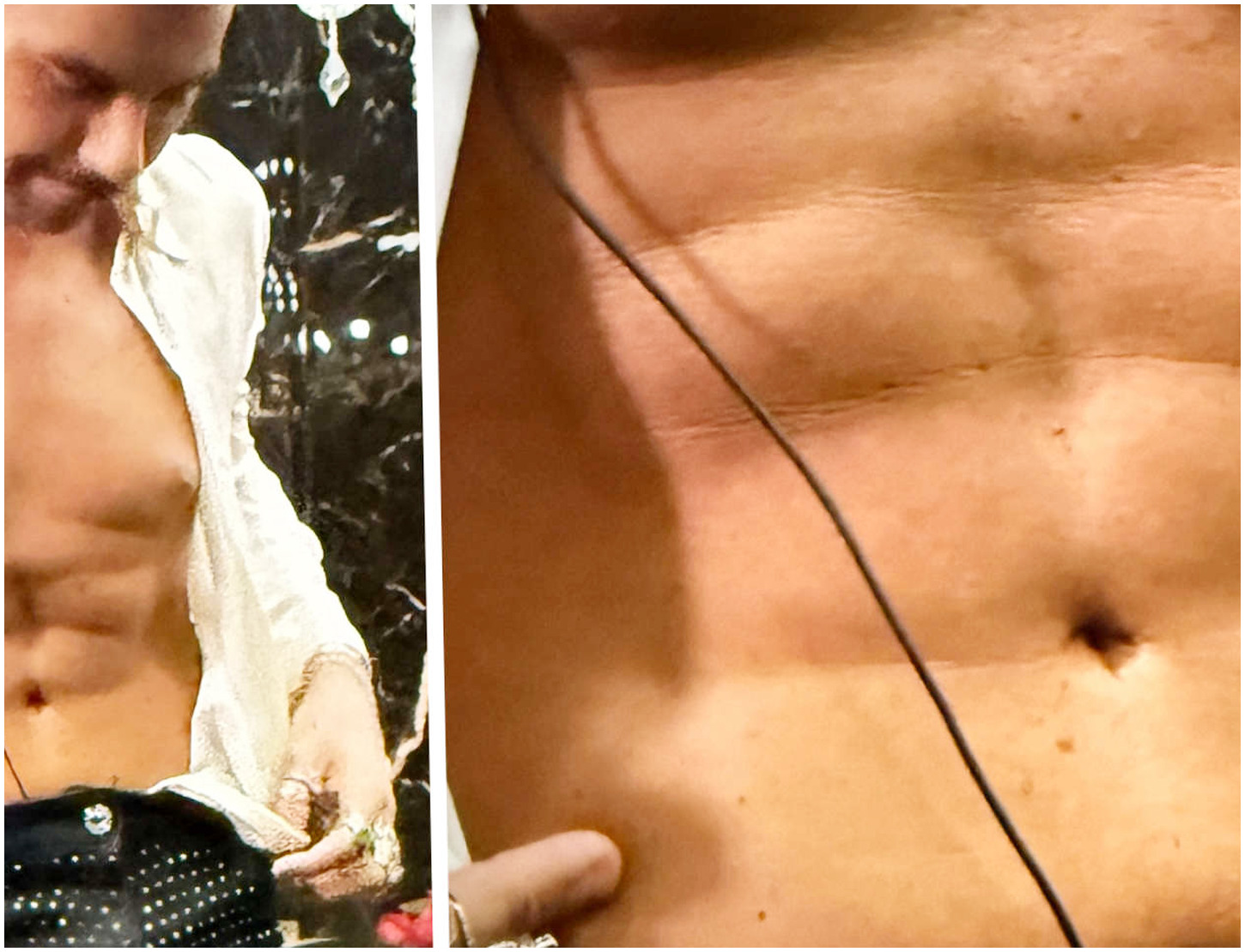 Federico Fashion Style racconta a Le Iene il suo percorso dopo l’addominoplastica e come l’ha trasformato