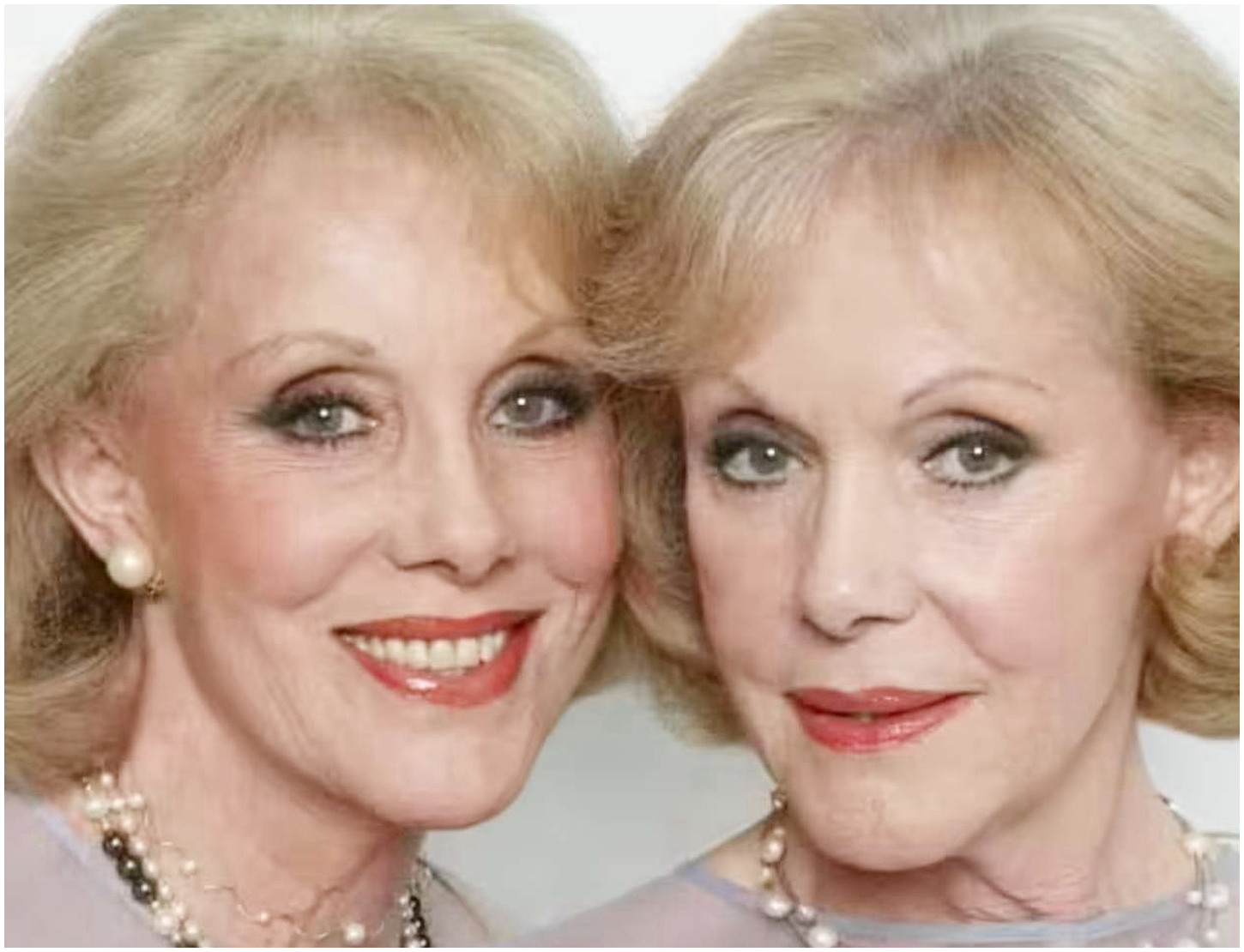 Gemelle Kessler: la vicenda dell’iniezione letale e un commovente gesto finale di amore fraterno