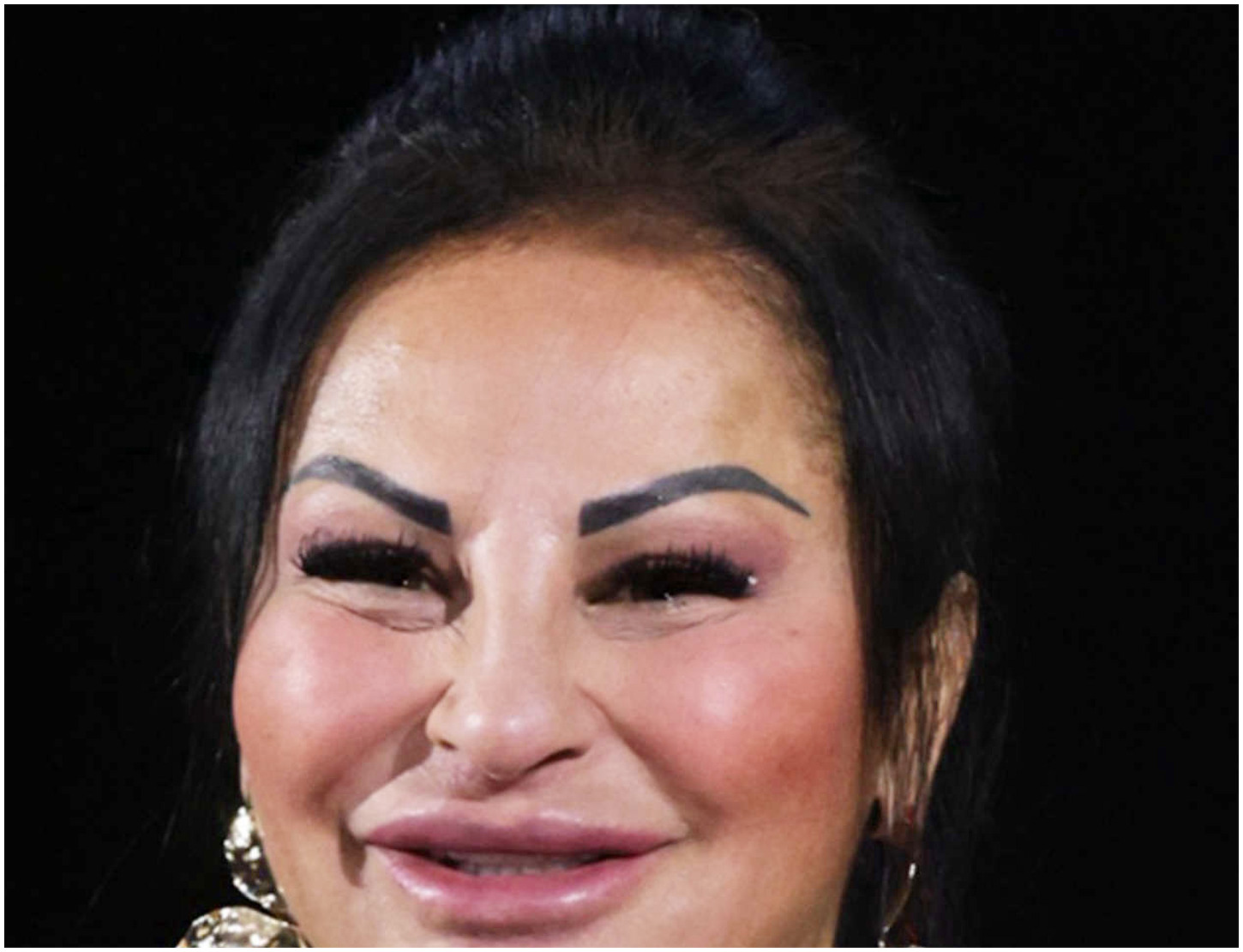 Le Iene Inside esplora la chirurgia estetica e le trasformazioni delle bellezze da rifare in tv