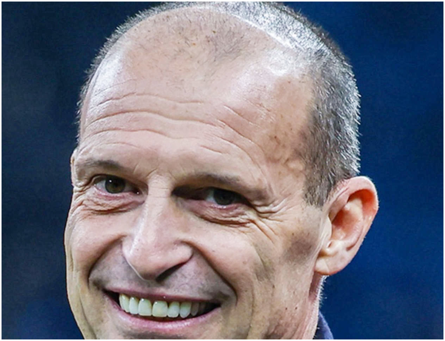 Milan-Lazio in diretta stasera: info su orario, tv, streaming e le ambizioni di Max Allegri