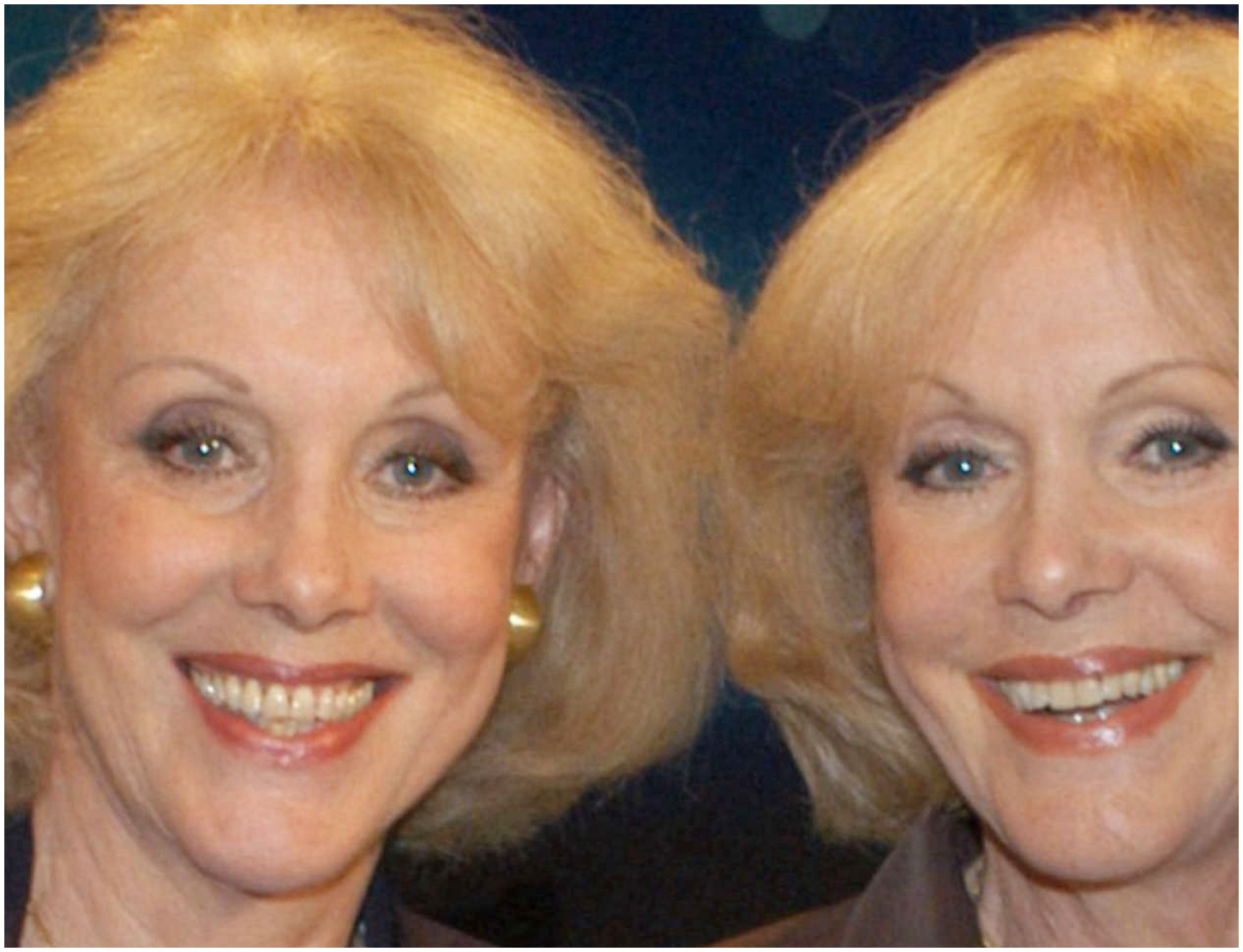 Morte delle gemelle Kessler, scelta inaspettata sulla sepoltura e l’eredità contesa