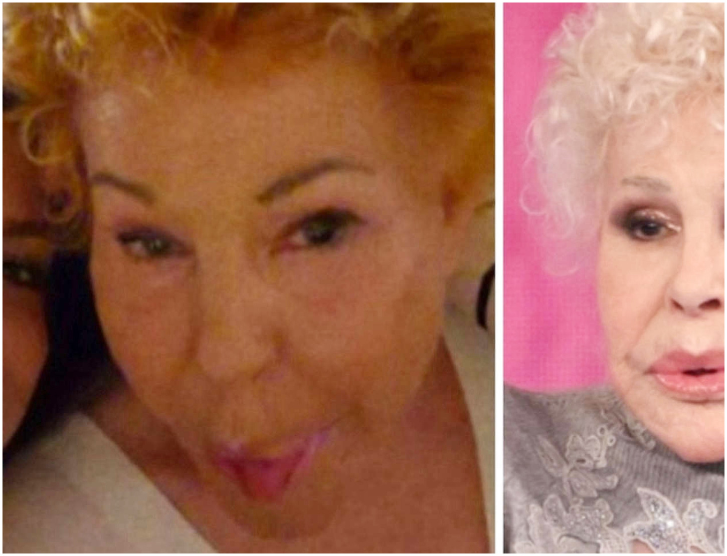 Ornella Vanoni racconta della visita inaspettata di Emma dopo l’operazione e le sue chiamate.