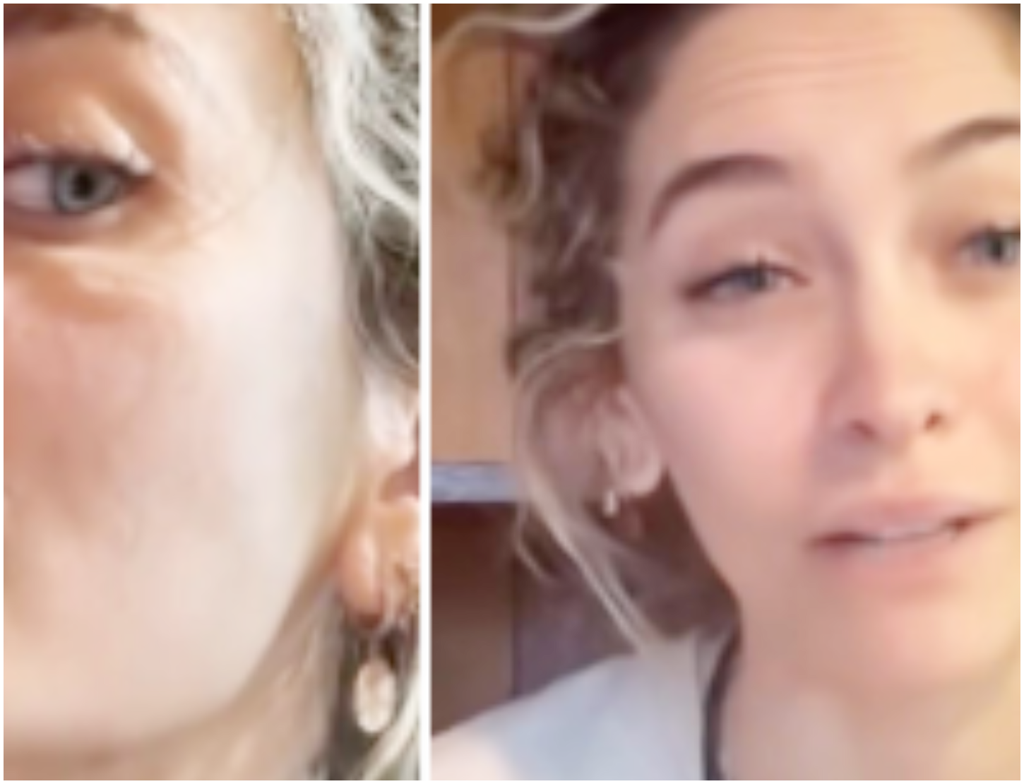 Paris Jackson, figlia di Michael, condivide la sua esperienza di salute dopo un setto nasale perforato