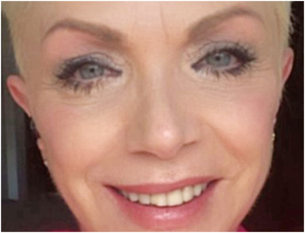 Rosanna Banfi racconta la sua paura prima dell’operazione per rimuovere il tumore ai polmoni