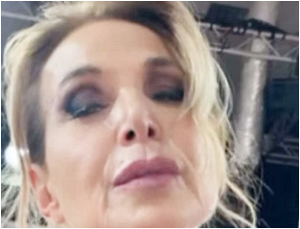 Barbara D’Urso si prepara per Ballando con le stelle indossando un tutore per la gamba