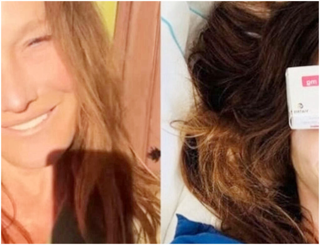 Carla Bruni racconta la sua battaglia contro il cancro tra chirurgia e terapie complesse