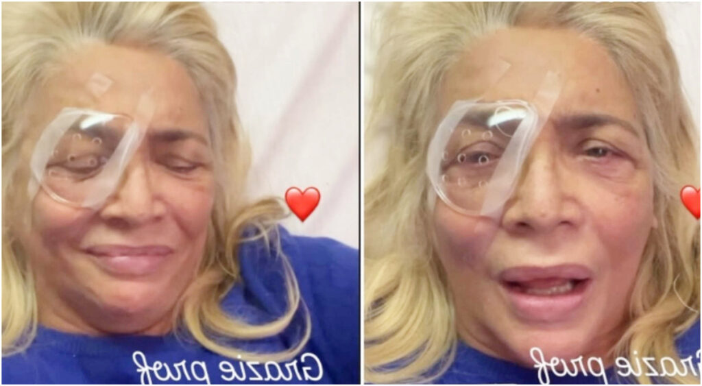 Mara Venier sottoposta a un nuovo intervento oculistico: le sue condizioni dopo il ricovero