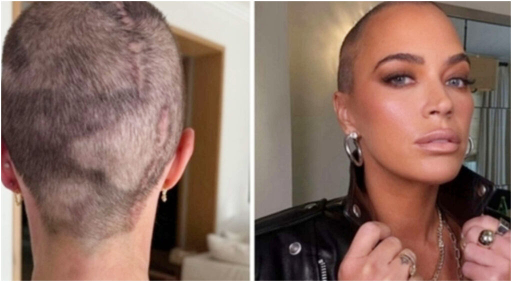 Teddi Mellencamp e la lotta contro il cancro al cervello, il padre parla delle sue difficoltà