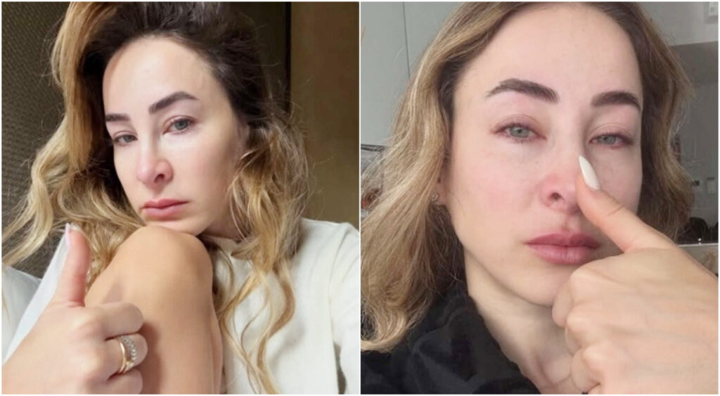 Carlotta Ferlito racconta il suo anno di lotta contro la depressione e il valore della vita.