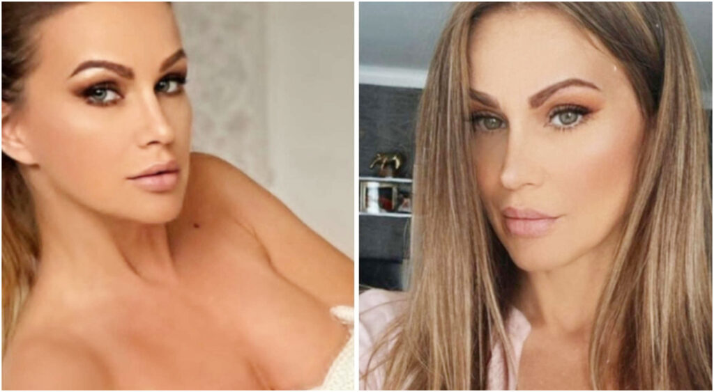 Eva Henger racconta come un intervento di 5 ore le ha ridato la mobilità dopo l’operazione al seno