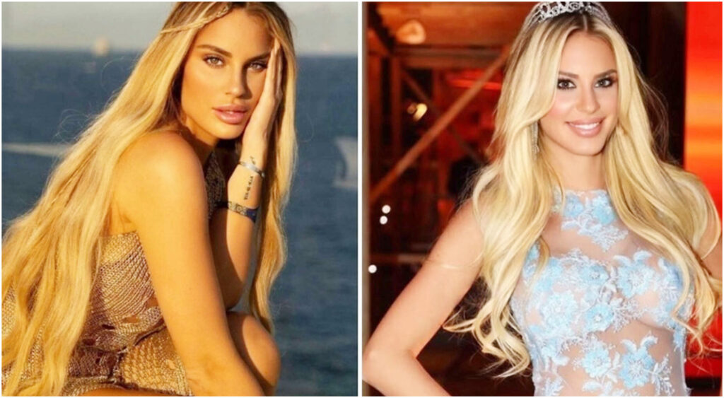 Francesca Brambilla racconta la sua esperienza di violenza: attivato il codice rosso per salvezza.