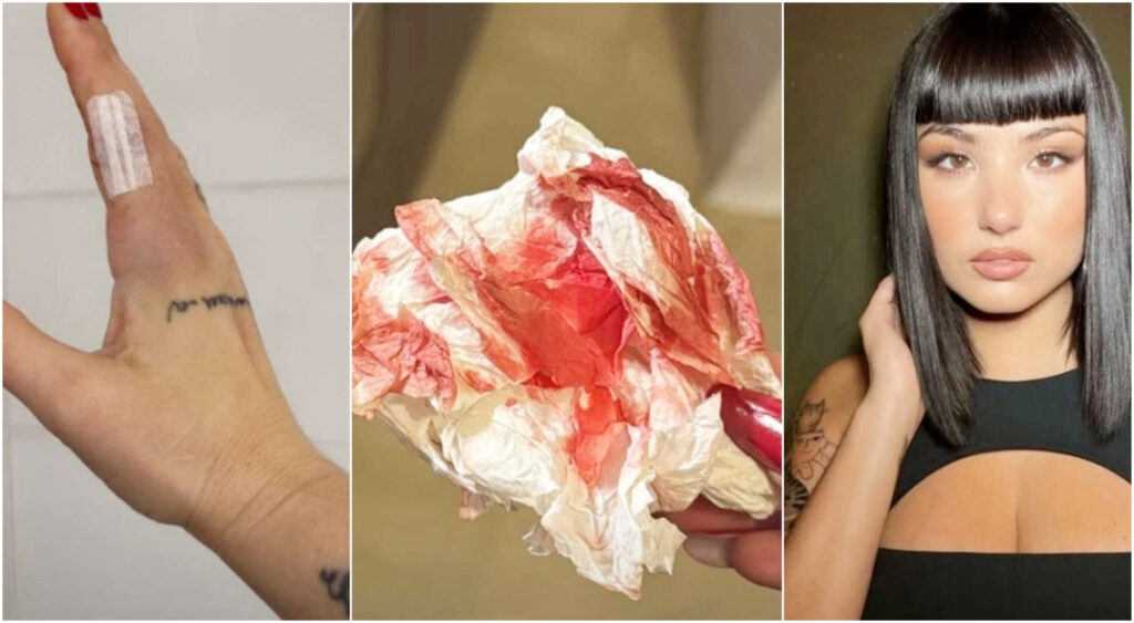 Giorgia Soleri ricoverata in ospedale dopo un incidente con un coltello: «La mia vita è uno scherzo»