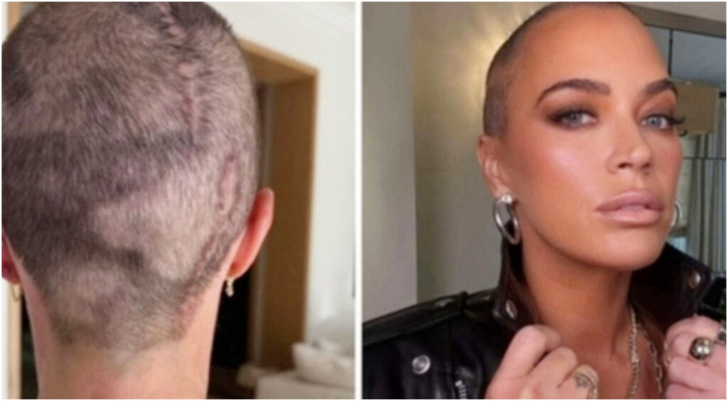 Ho superato il cancro e il divorzio, ma la paura della malattia reca ancora con me