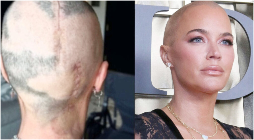 Dopo il cancro e le operazioni, un percorso di rinascita per ritrovare la propria identità