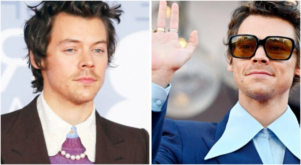 Harry Styles parla di calvizie: trapianto di capelli o parrucca? L’opinione sulla genetica familiare