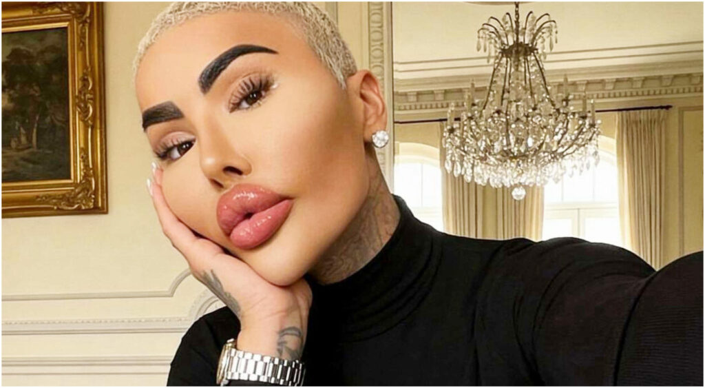 Jordan James Parke trovato morto a 34 anni, celebre per le sue labbra ispirate a Kim Kardashian