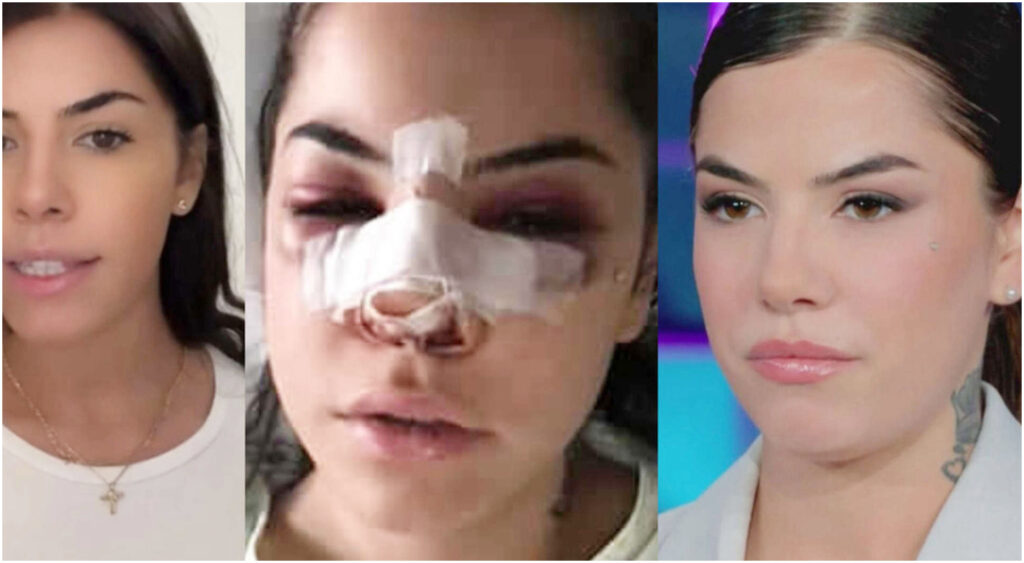 Chiara Balistreri lamenta riduzione della pena per l’ex fidanzato violento: una doppia vittima