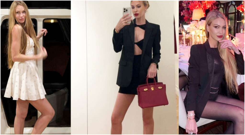 Taylor Mega rivela il suo uso del botox: non solo estetica, ma un trattamento efficace ogni sei mesi